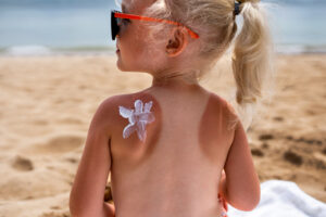 A young child with blond hair, wearing sunglasses, sits on the beach with a visible sunburn and sunscreen in the shape of a flower on their shoulder—reminding us that kids summer safety and sun protection are essential for fun without sunburn.